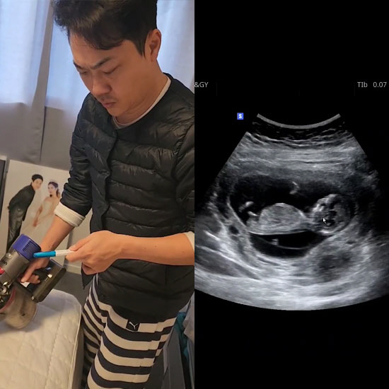 NRG 이성진 "결혼 2주년, 아빠 됩니다"…'47세' 늦깎이 아빠 대열…