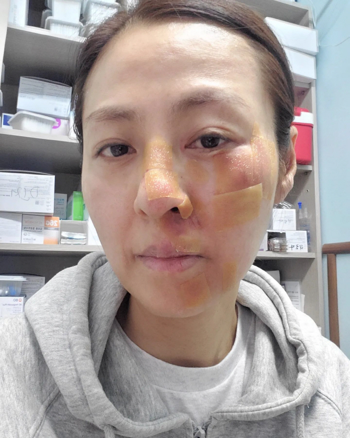 배우 전혜진, 충격적 사고 소식…"쇠파이프에 걸려 얼굴 콘크리트 바닥에 …
