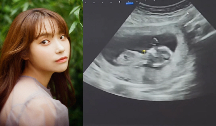 [공식] 이진아, 결혼 6년만 깜짝 임신 발표 "아기천사 찾아왔다"