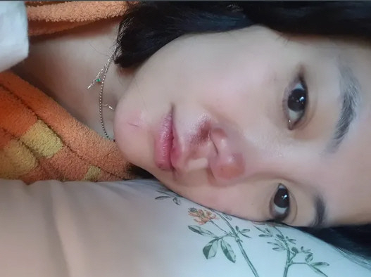 '코 재수술→안면부상' 고은아, 성형외과 검진서 뜻밖의 결과 "너무 무서…