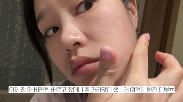 '둘째 임신' 헤이지니, 해외서 급격히 나빠진 상태 "충격적"