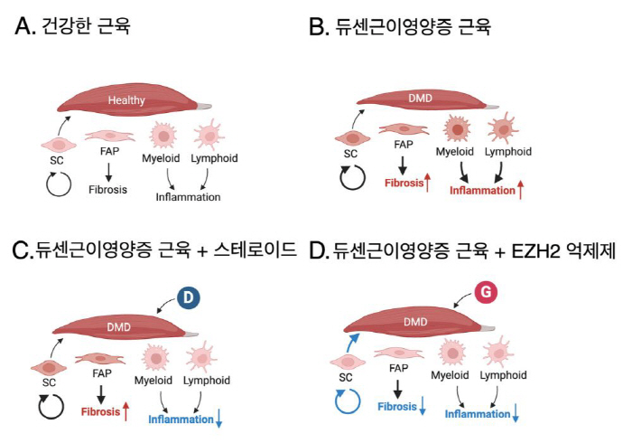 희귀질환 '듀센근이영양증' 새 치료 전략 제시…EZH2 억제제+스테로이드…