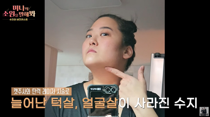 '미나 시누이' 수지, '60kg 감량+시술' 후 사라진 팔뚝살+턱살 비…
