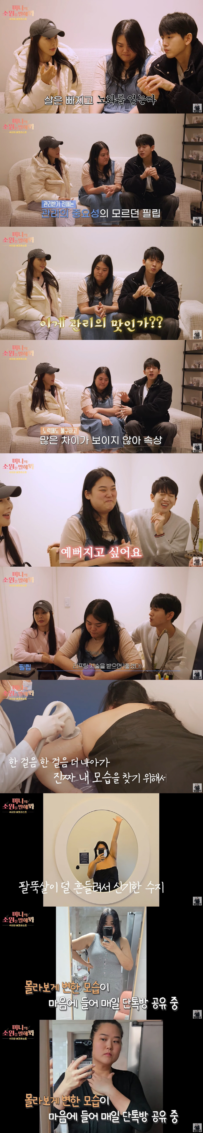 '미나 시누이' 수지, '60kg 감량+시술' 후 사라진 팔뚝살+턱살 비…