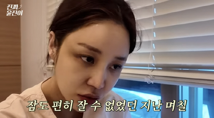'화상 피해' 윤진이, 둘째 출산 후 진통제 투혼 "몸 쇠약해져, 잠도 …