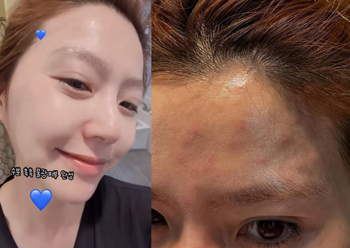 '주영훈♥' 이윤미, 화장품 테스트하다 피부 문제 발생..안타까운 근황