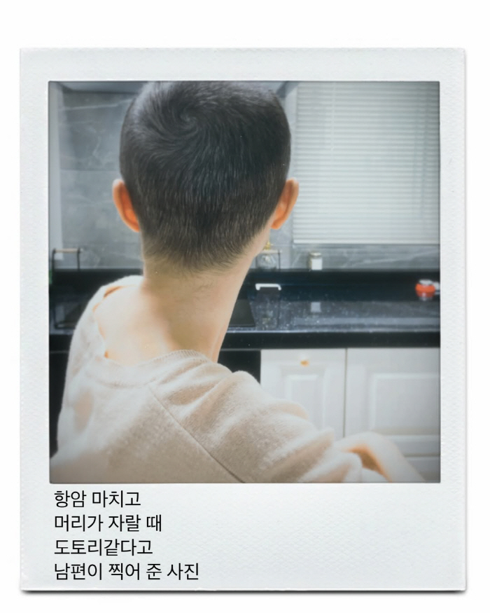 '박성광♥' 이솔이, '여성암 투병' 삭발 후 머리숱 고민..."치료 티…