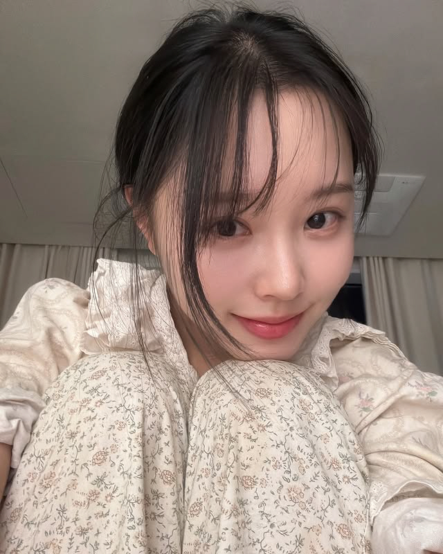 '여성암 투병' 이솔이, 눈 건강도 적신호 "손주까지 보고 싶은데"
