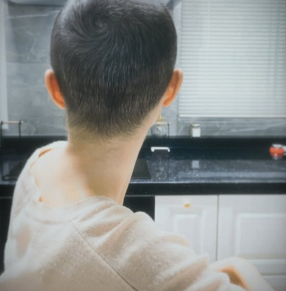 '여성암 투병' 이솔이, 눈 건강도 적신호 "손주까지 보고 싶은데"