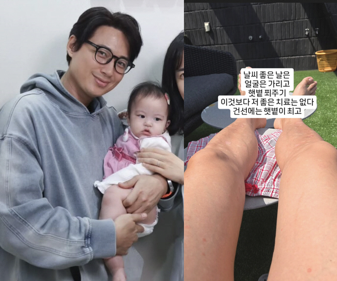 이지훈, 9개월 딸과 앓고 있는 피부병 고백 후...옥상서 "건선엔 햇볕…