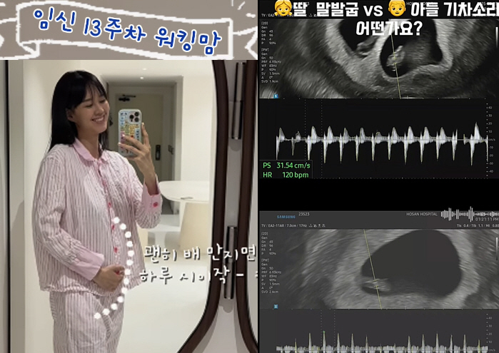 '난임 극복' 지소연, 쌍둥이 임신 13주차 초음파 공개 "딸 vs 아들…