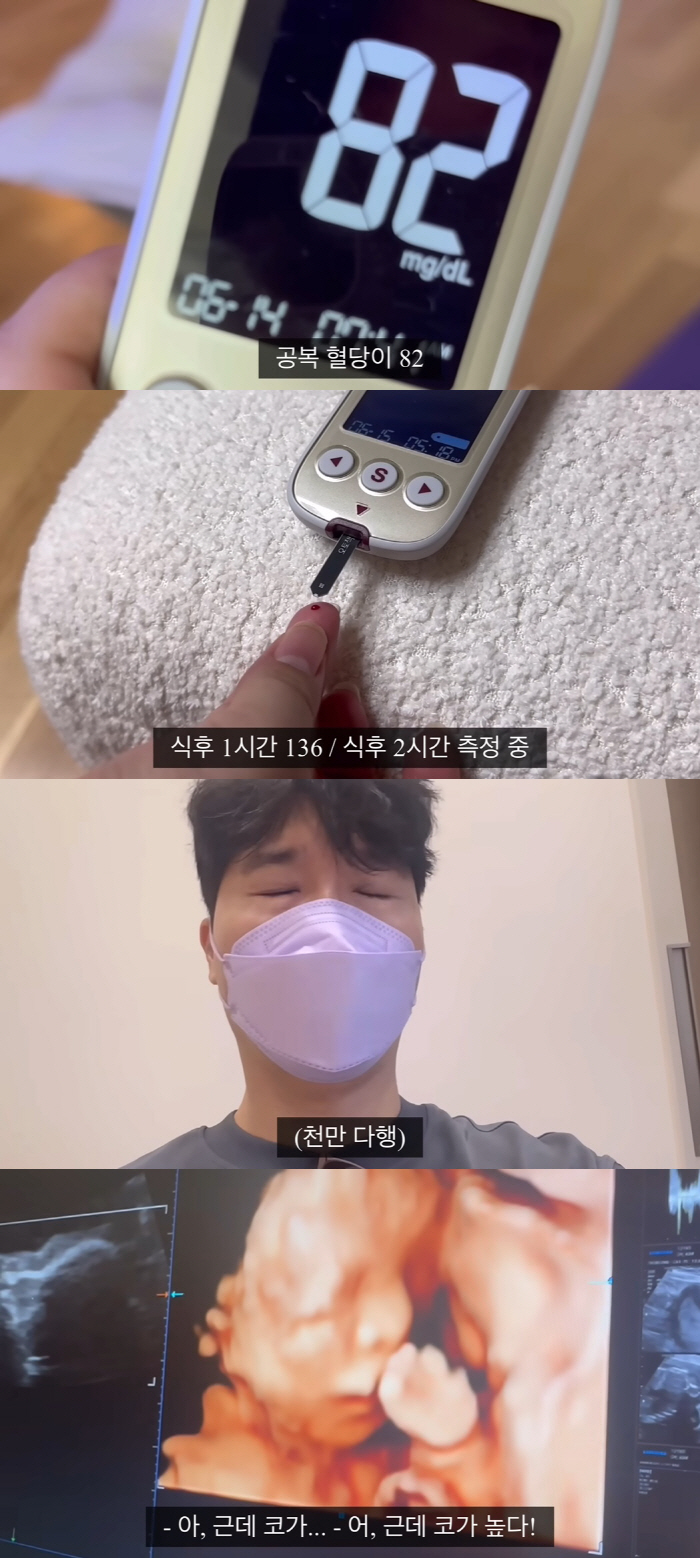 'Park Soo Hong ♥' Kim Daye Thoroughly manages blood sugar → Surprise on ultrasound photo 'Abalone has a high nose!' (' be happy)Hong')