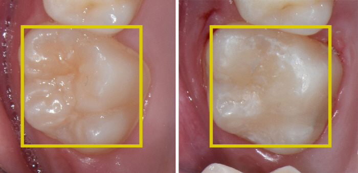 What are the dental checkups and treatment items for infants and adolescents and health insurance?