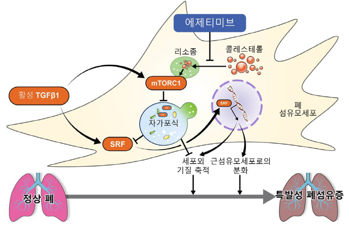 Anti-cholesterol drug 'Ezetimib' reduces lung fibrosis progression risk by up to 62%