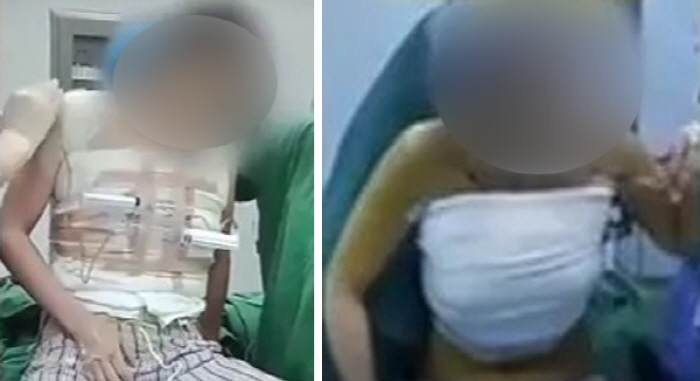 Video of breast enlargement surgery leaked online 'Shock'…Exposing your face, too