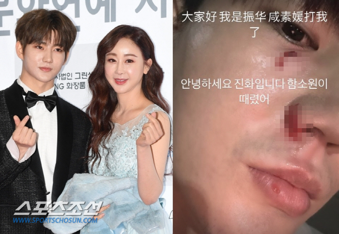 Evolution, with a bleeding face 'Ham Sowon hit me' Revealed...a violent marital quarrel