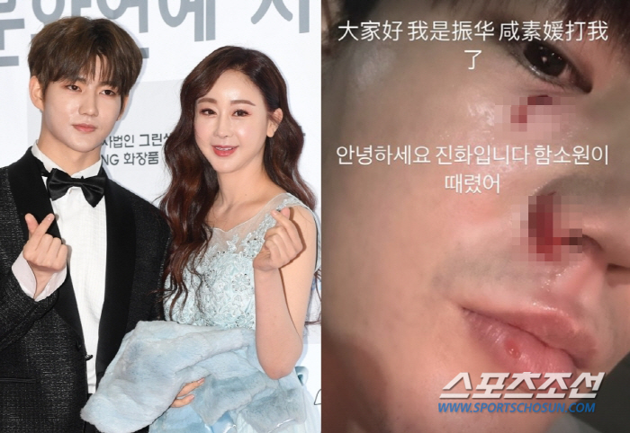 ''Ham Sowon hit me.'' Evolution, bloodied face..a couple's fight that turned into domestic violence