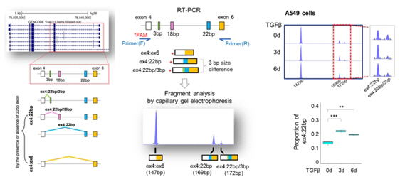 Discovery of new markers for cancer distant metastasis The development of diagnostic tools and treatments is expected