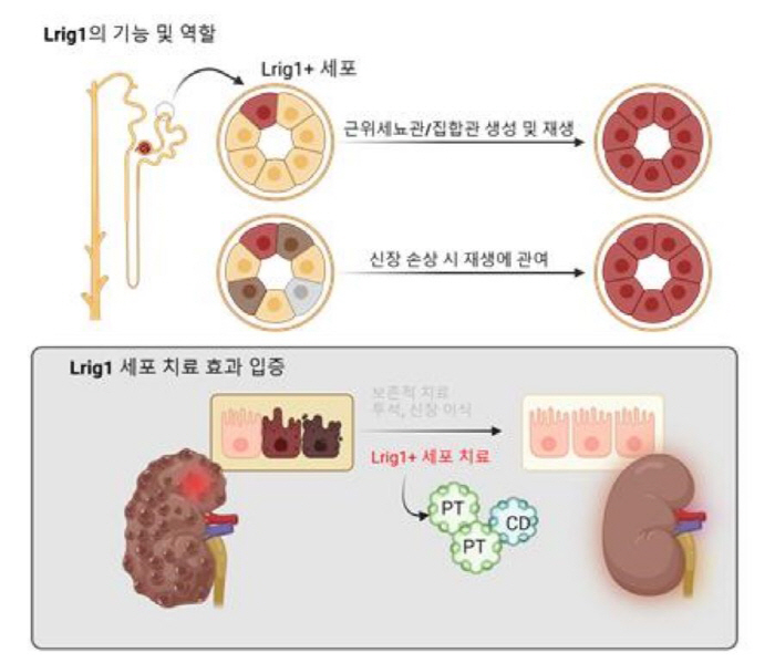 Successfully discovered stem cell markers to confirm the possibility of developing end-stage kidney disease cell therapy