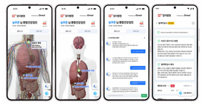 H Plus Yangji Hospital Introduces AI Solution in Health Examination Results