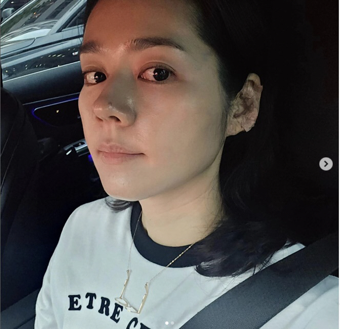 Han Ga-in complains of 'Yeon Jung-hoon ♥' conditions..In the end 'I got hematologic therapy'