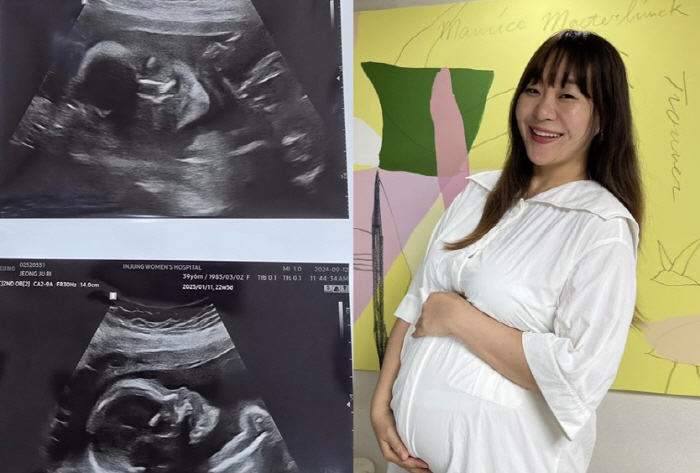 'January Birth'Juju-ri, '5th Son' Ultrasound Pictures Unveiled'