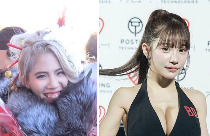 A woman who spent 200 million won on plastic surgery has changed 180 degrees in her life, turning a part-timer into a influencer