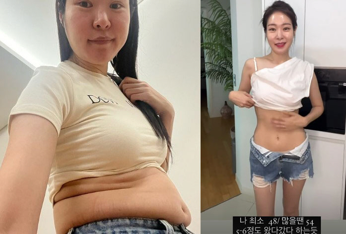 Where did 'Kim Tae-hyun ♥' Mija fold in layers 'Thick belly fat' go...Before and after the shock diet