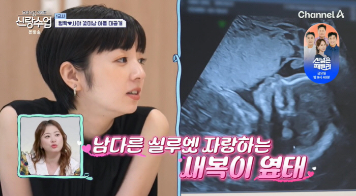 'Face genius' Shim Hyung-tak ♥ Saya, 2nd generation ultrasound revealed...Even the doctor recognized 'Handsome'('Brand Class')