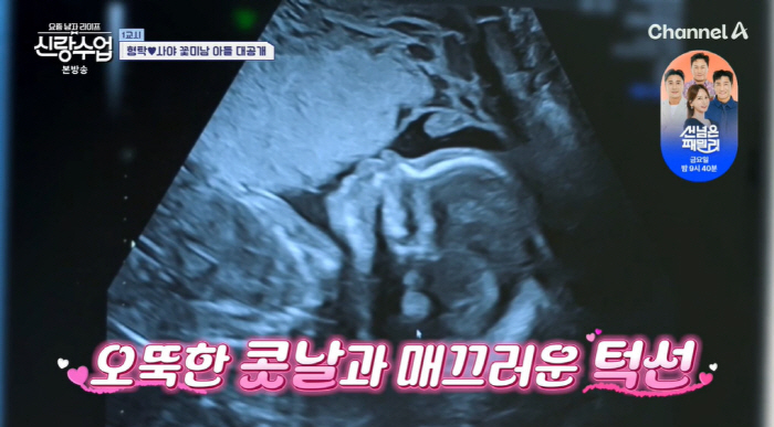 'Face genius' Shim Hyung-tak ♥ Saya, 2nd generation ultrasound revealed...Even the doctor recognized 'Handsome'('Brand Class')