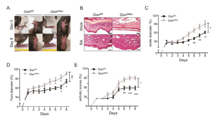 Prediction of Rheumatoid Arthritis and Finding Key Substances for Treatment