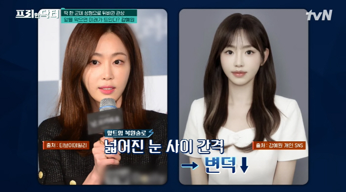 Kang Ye-won, it's a plastic surgery..Changed the physiognomy 'Second heyday''Free Doctor'