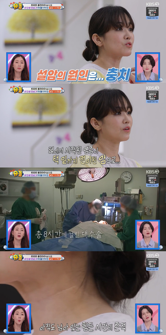 Jeong Mi-ae revealed the cause of Seolam, 'Because of the cavity...' 'One-third of tongue restriction' (Shudol) 