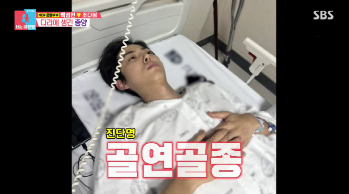 Baek Sung-hyun, a late-discovered tumor..In the end, emergency surgery 'upper and lower body warp'Same Bed, Different Dreams 2'