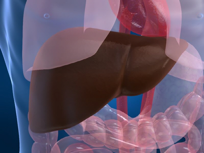 Increased risk of liver cancer 'Hepatic fibrosis'Early diagnosis is key