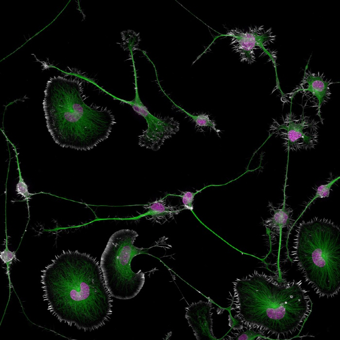 1st place in the optical microscope photo exhibition is 'Rat brain tumor cells' 2nd and 3rd place are also art