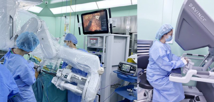 Breast cancer treatment is also possible with single-hole robotic surgery. Less worry about scars and aftereffects