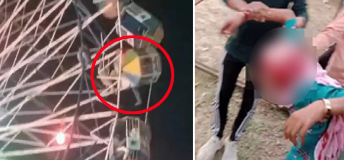 Teenage girl with hair on the ride, even ripped off her scalp 'Terrible'