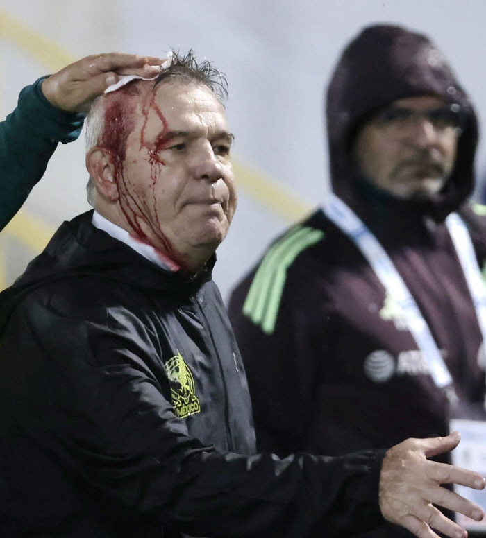 Mexican Coach Habier was hit by a fan-throwing can, causing a devastation