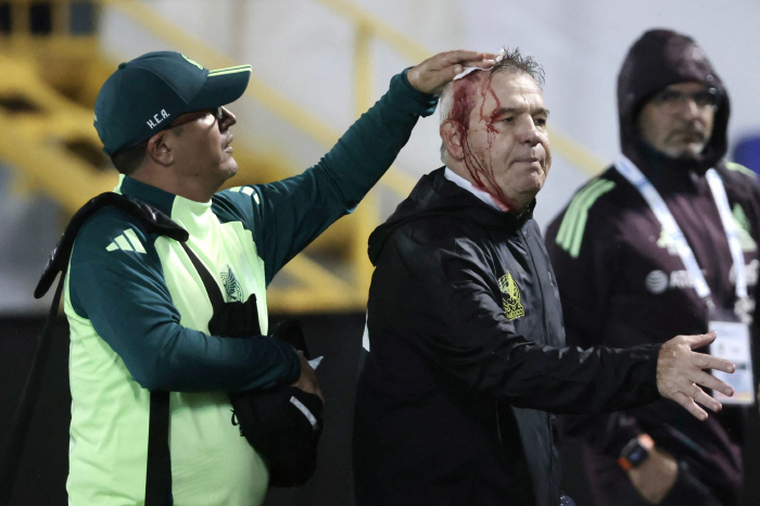 Mexican Coach Habier was hit by a fan-throwing can, causing a devastation