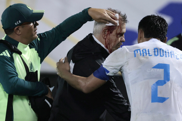 Mexican Coach Habier was hit by a fan-throwing can, causing a devastation