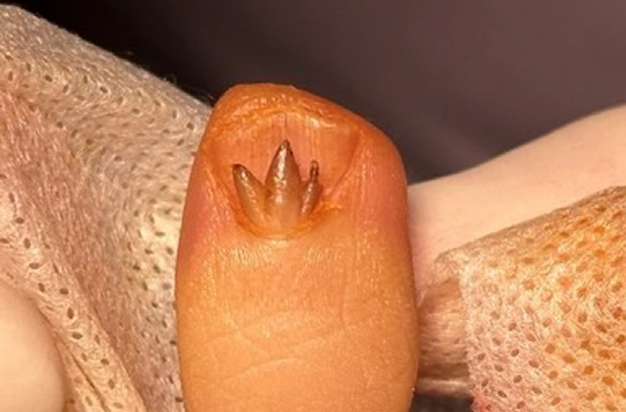 Why Maserati 'Trizzang' logo on a woman's fingernail in her 20s?