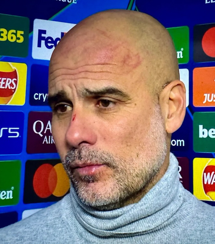 'Red face hurt → self-inflicted remarks' Guardiola finally apologized for the worst days, and did he renew his contract 'poison'