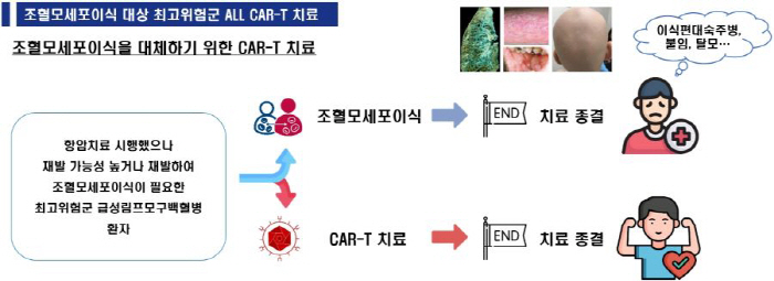 Seoul National University Hospital Expands CAR-T Treatment for Children and Adolescents with Acute Lymphocyte Leukemia