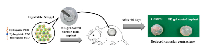 Nanoemulsion-based drug delivery system, breast prosthesis surgical complications 'Spherical Construction'Prevention