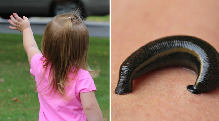 16 month old daughter finds leech in genitalia 'Shock', how?