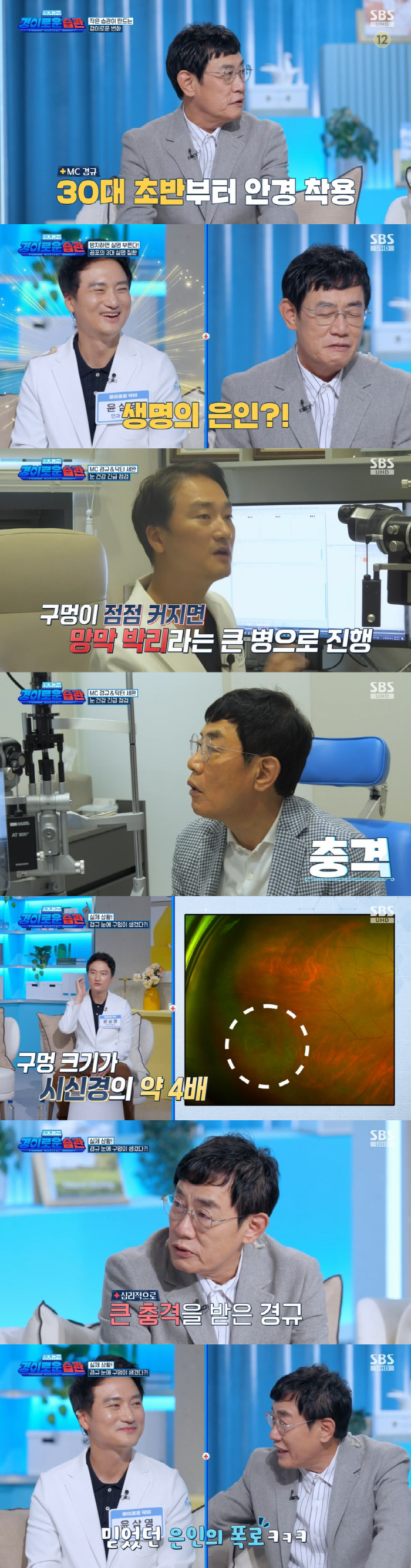 Lee Kyung Kyu, serious eye disease...Blindness Crisis in a Large Retinal Hole 'Psychological Shock'('Wonderful Habits')