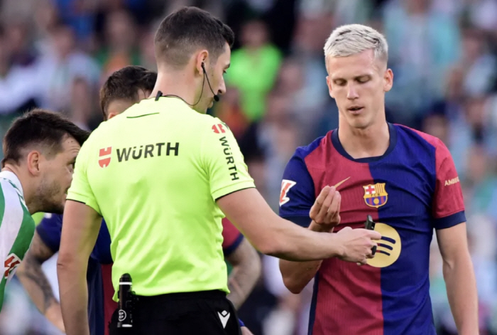 Looking for teeth on the lawn. But this actually happened. Barcelona Olmo Finds Lost Teeth