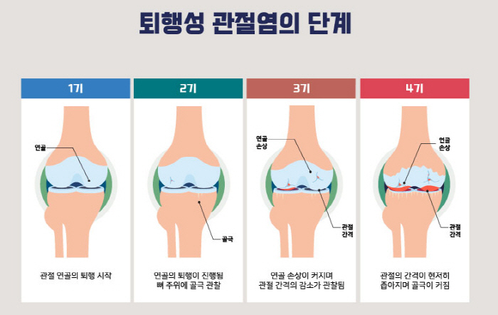 I'm worried about my mom's knee in the cold wind...Pain exacerbated by decreased blood circulation and muscle stiffness