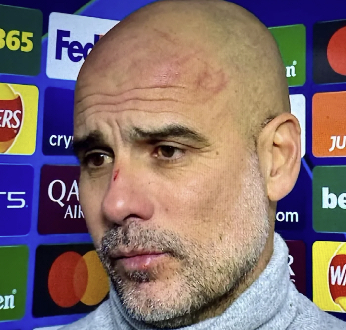 Face bloody  red wound Guardiola, shocking self-harm → There was a reason to hidea problem that has been afflicted for years